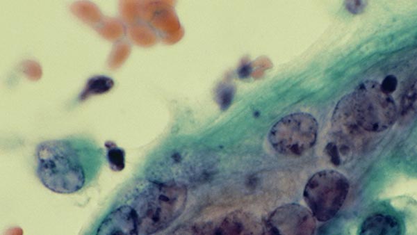 Infectious Diseases