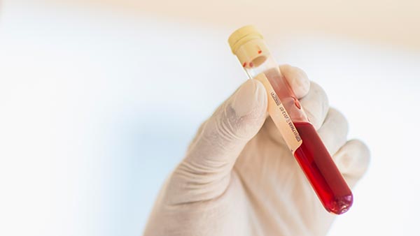 Lipids and Metabolic Diseases - Internal Medicine Subspecialties Clinic