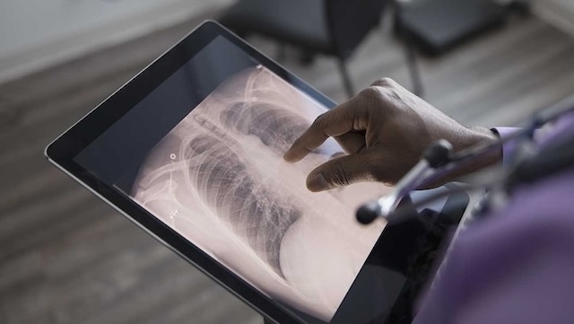 A doctor examining in on X-rays