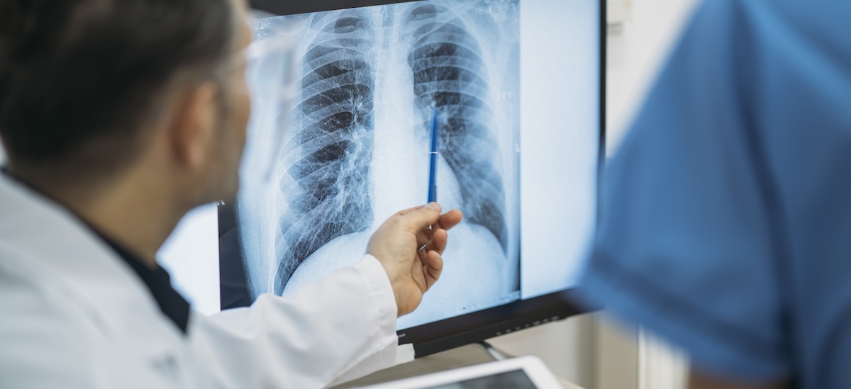 Interventional Pulmonology Clinic