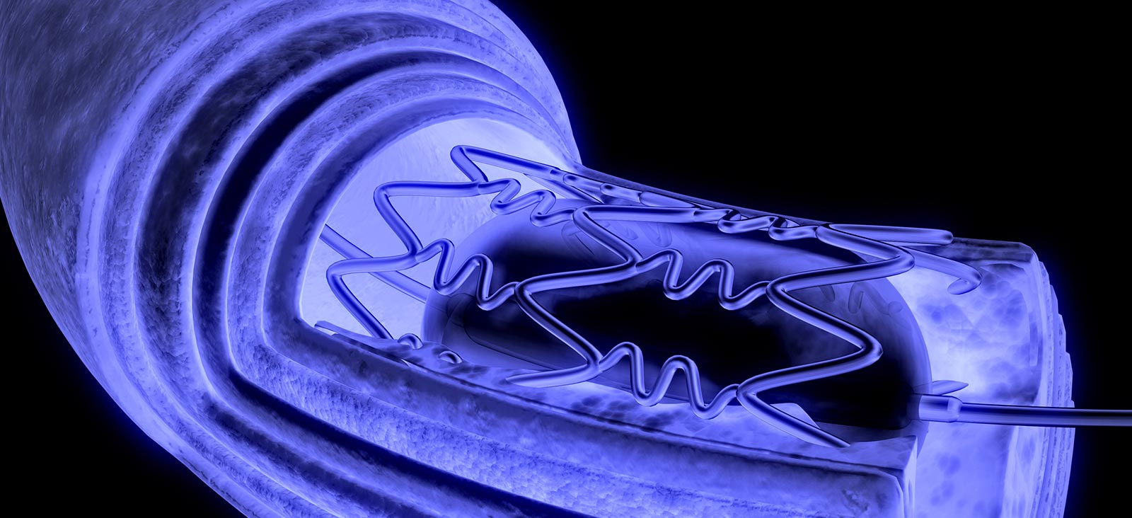 Image Here
