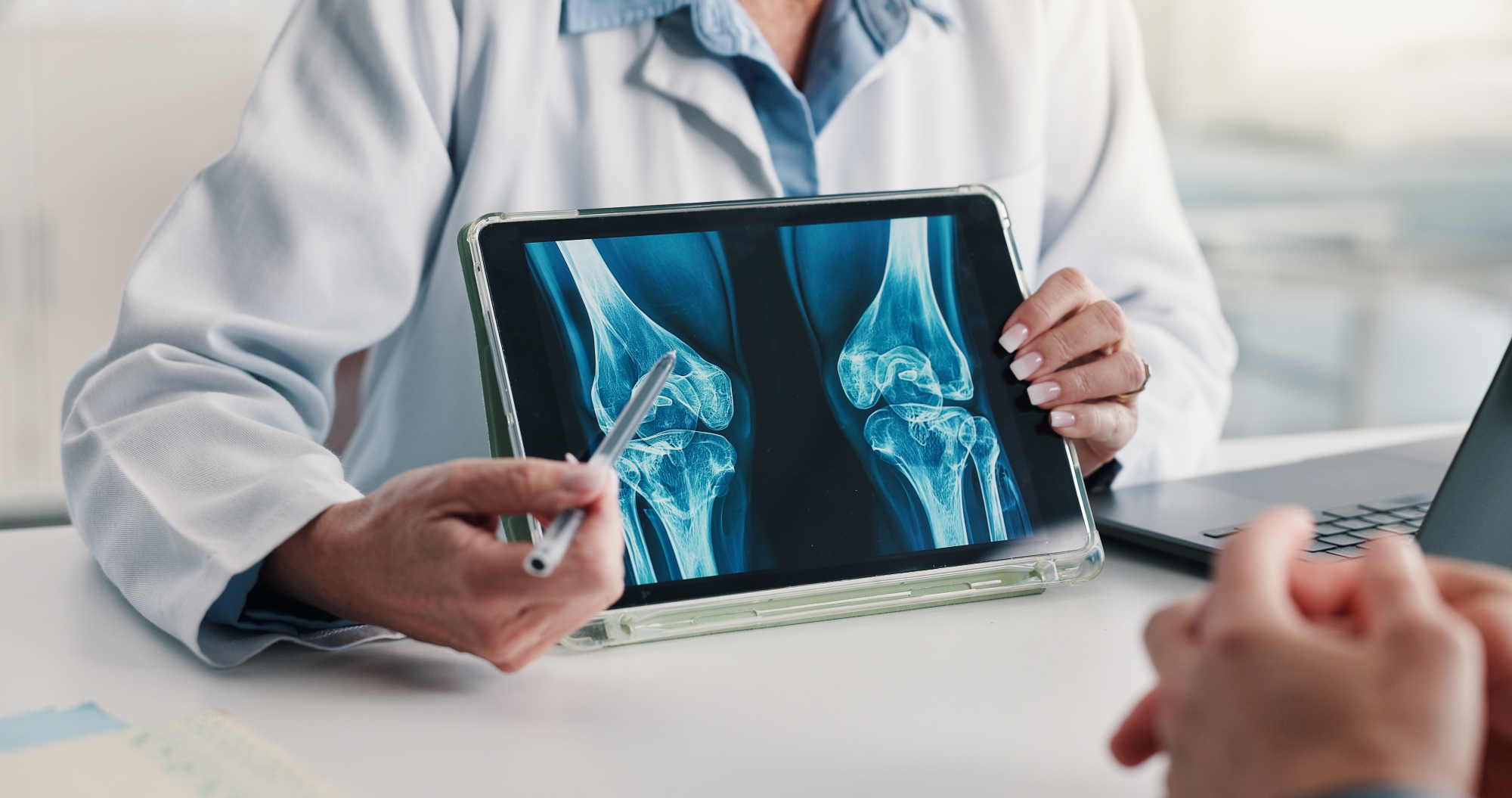 Doctor holding tablet that shows imaging of the knee