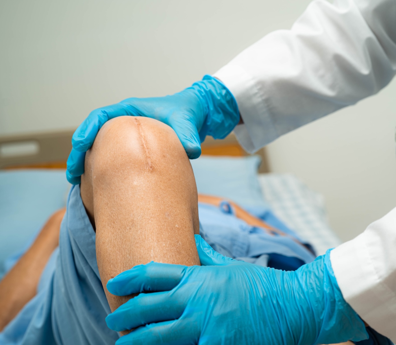 Provider showing a patient a model of a knee
