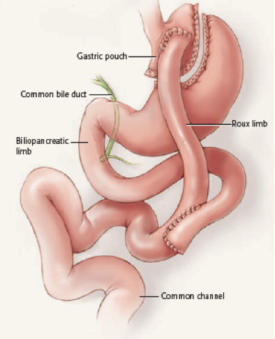 An image showing the stomach and small intestine.