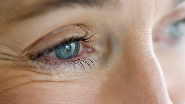 LASIK