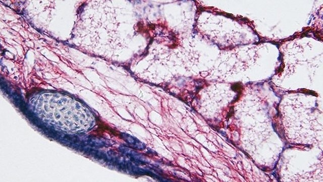 Close-up of lung tissue