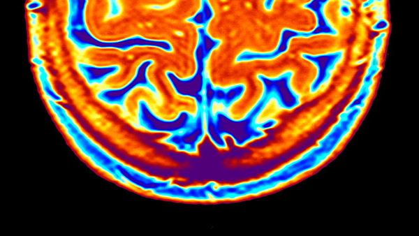 Magnetic Resonance Imaging