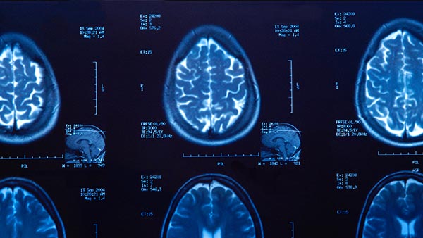 Advanced Imaging Clinic