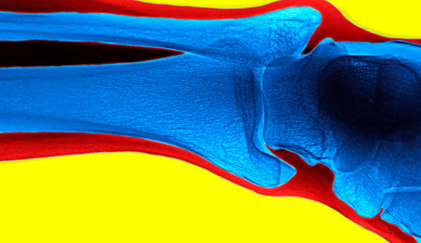 Musculoskeletal Radiology