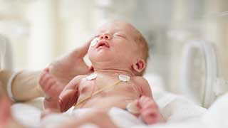 A premature newborn baby lies in an incubator, with medical sensors attached to its chest and a hand gently touching its head.