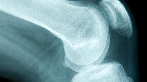 Department of Orthopaedic Surgery