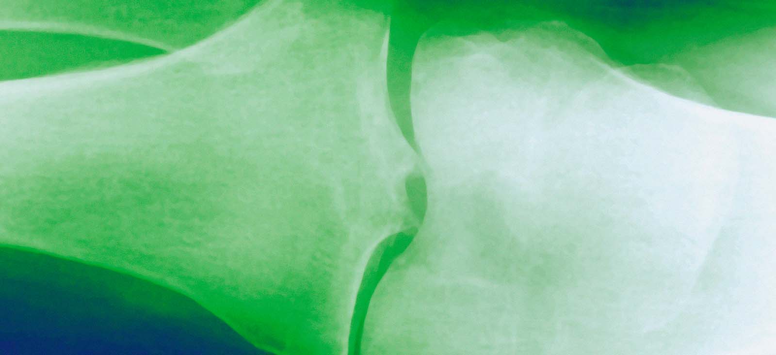 Image Here