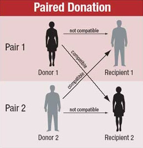 Diagram illustrating the paired donation process for living kidney transplants.