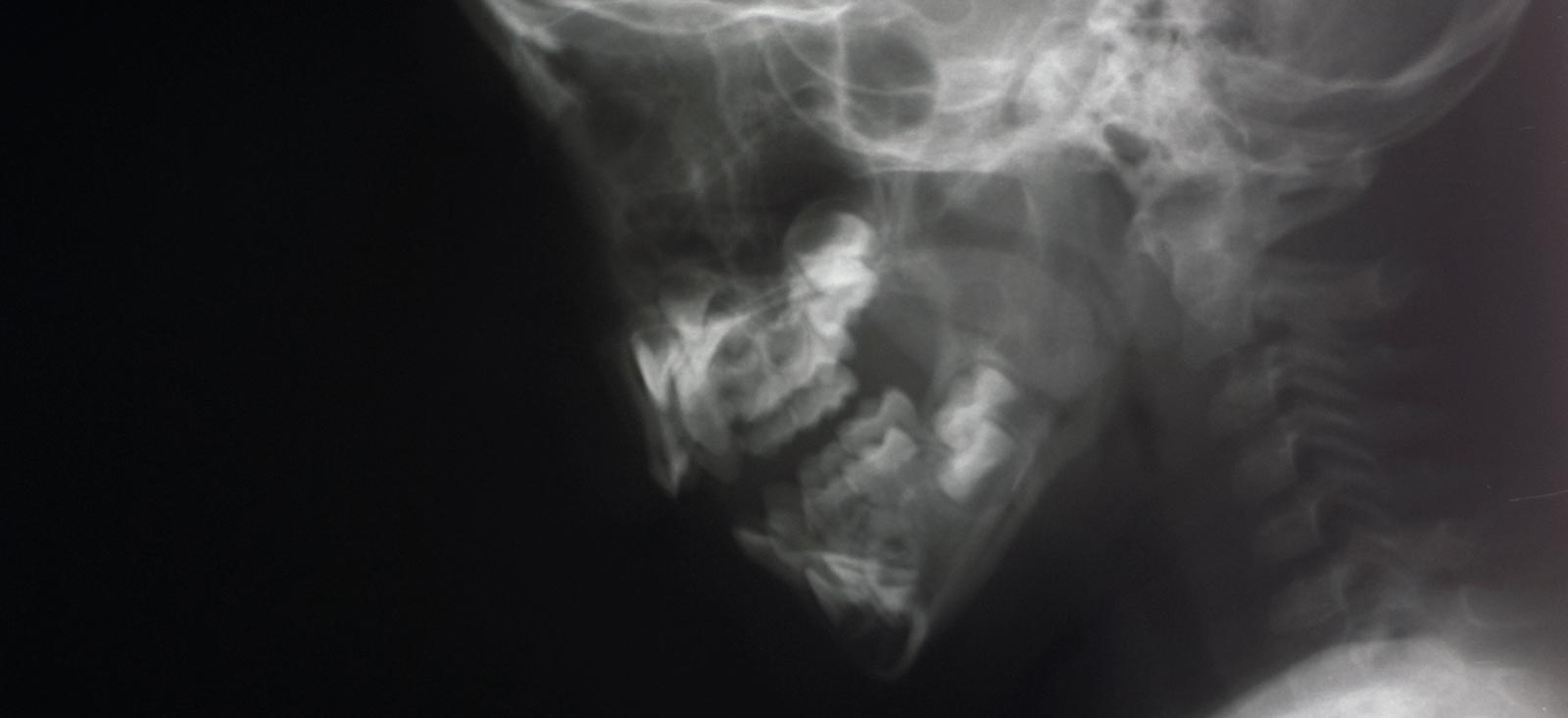 Image Here