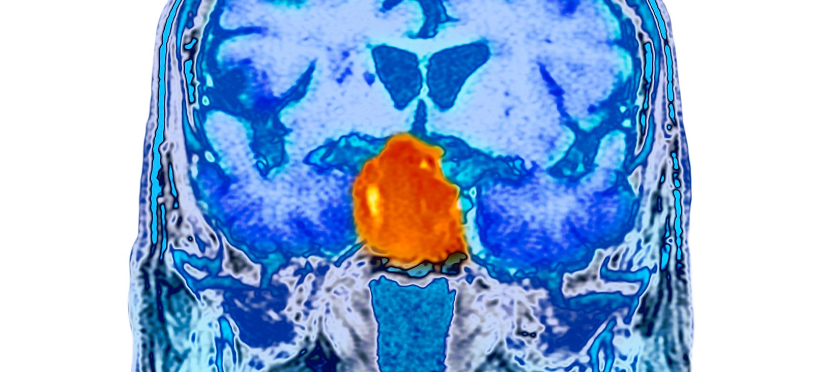 Image Here