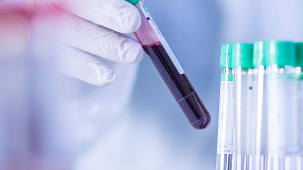 University Hospital Outpatient Laboratory