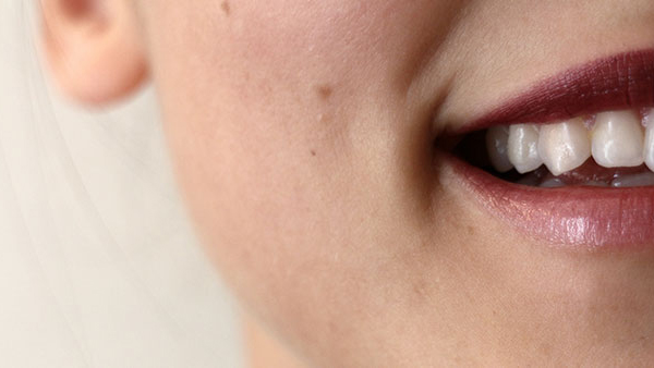 Restoration of Smile