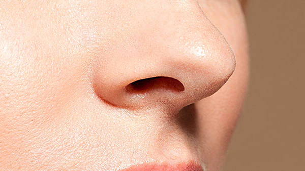 Rhinoplasty