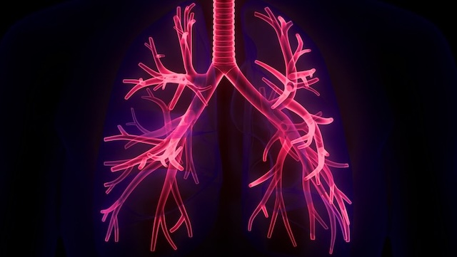 visual representation of Sarcoidosis in the lungs. Black background and neon outline of lungs.