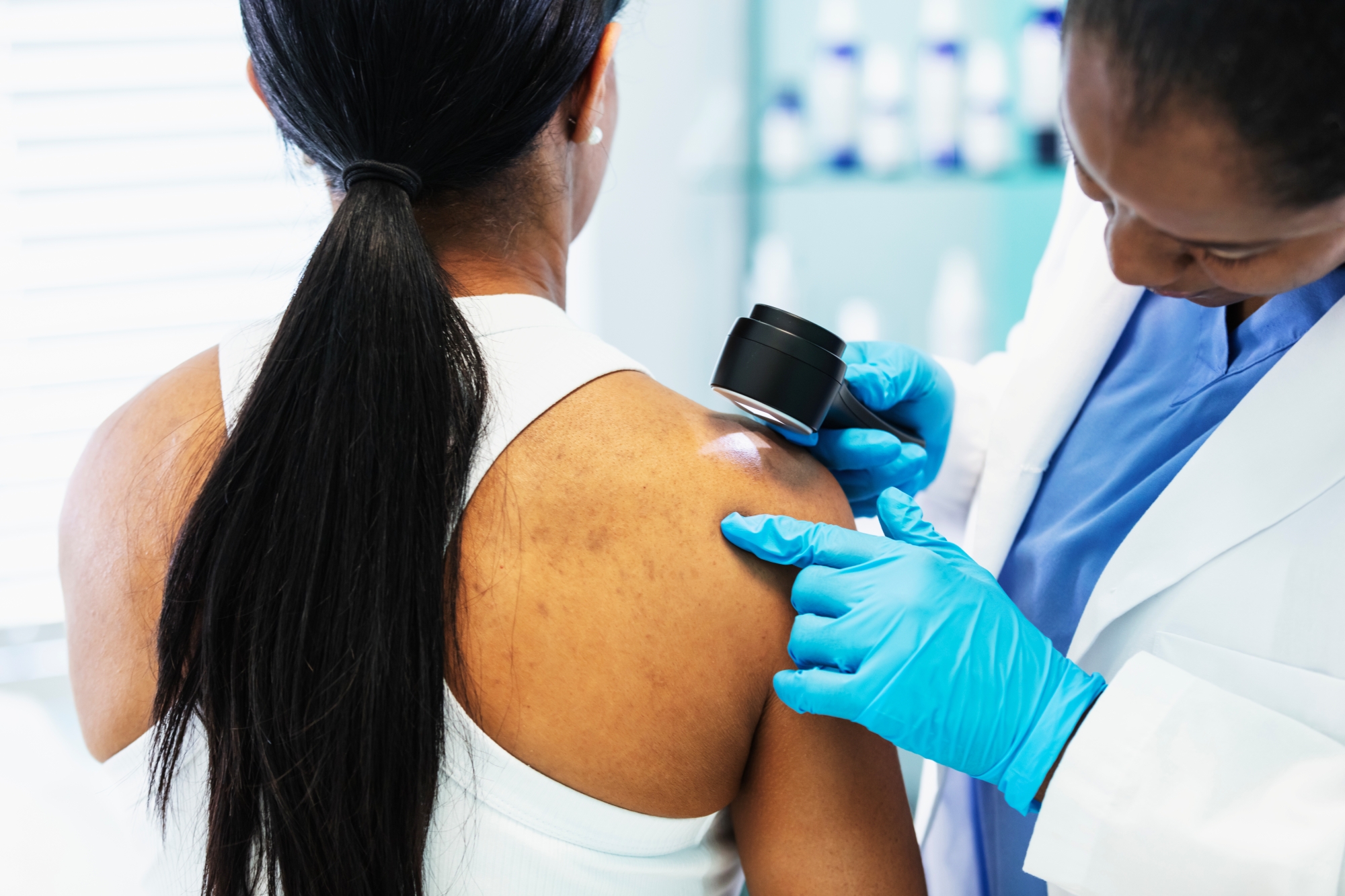 Skin cancer screening: What to look for and when to see a dermatologist