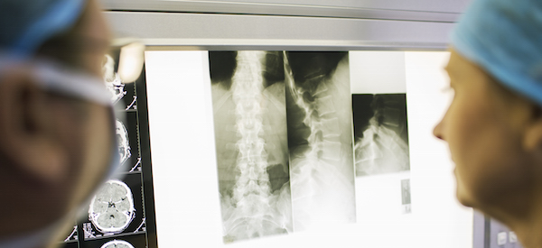 Spinal Cord Cancer