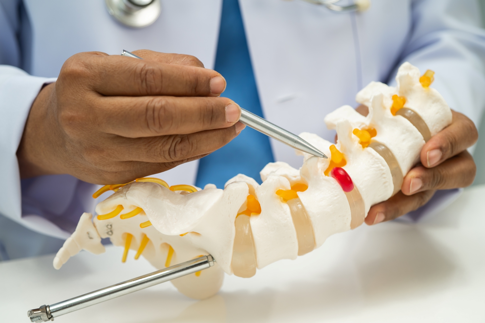 Physician's hands holding model of lumbar vertebra bone skeleton