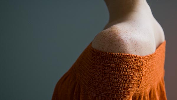 Melanoma and Sarcoma Clinic