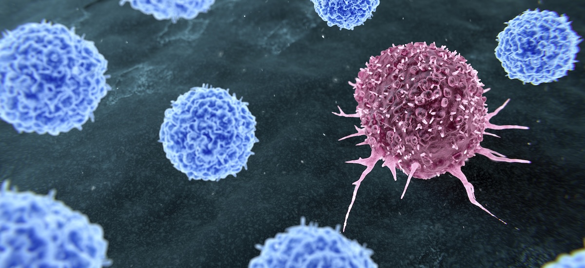 Tumor-Infiltrating Lymphocyte (TIL) Therapy