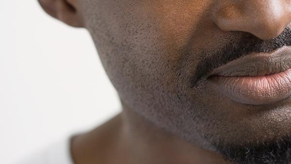 TMJ, Facial Pain, and Nerve Injury