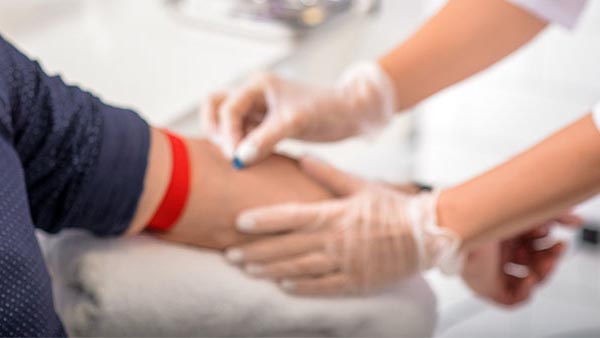 Venous Sampling