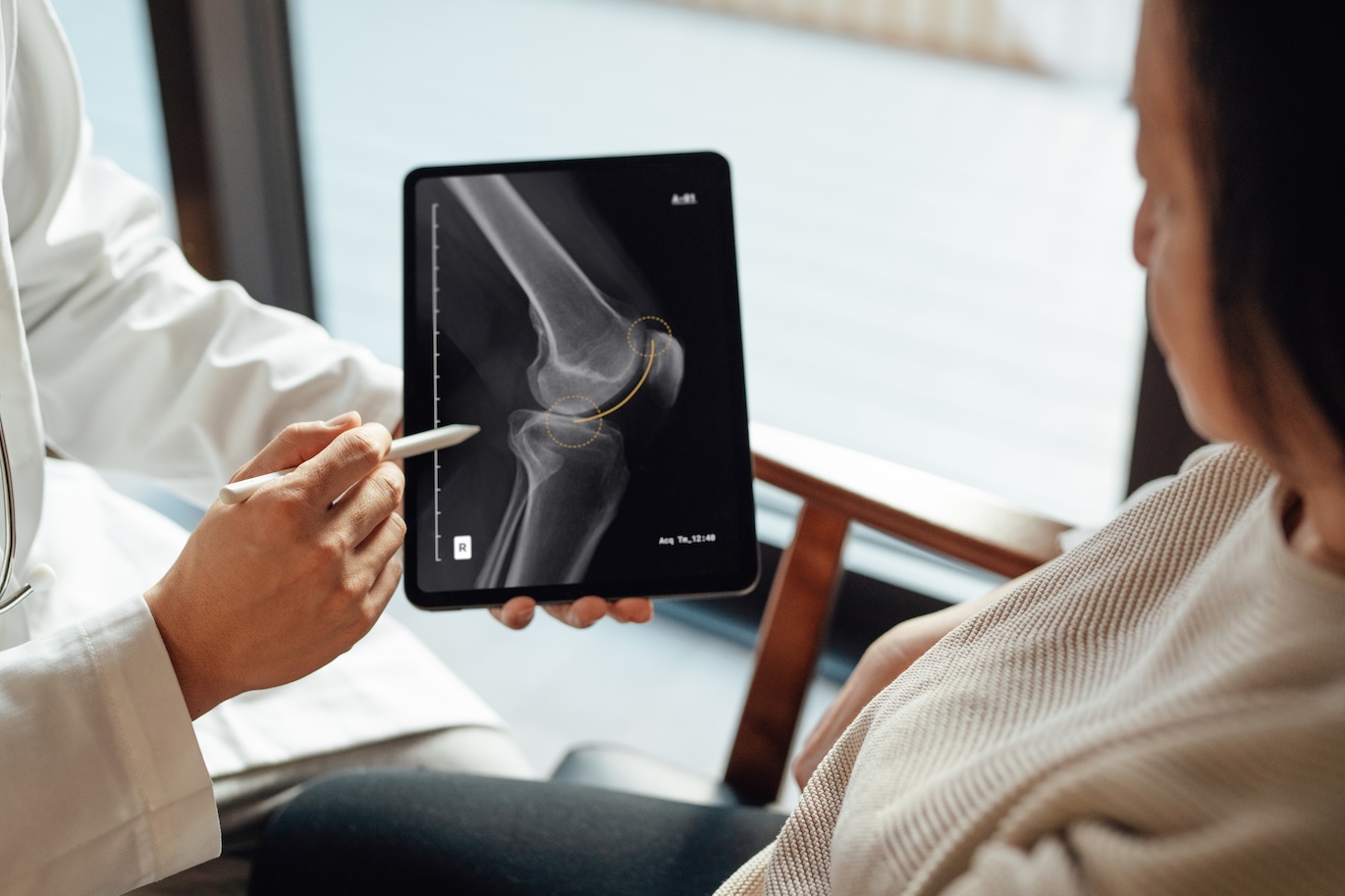 doctor holding a tablet in front of a patient with an xray of a knee