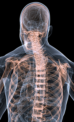 x-ray of a spine with black background